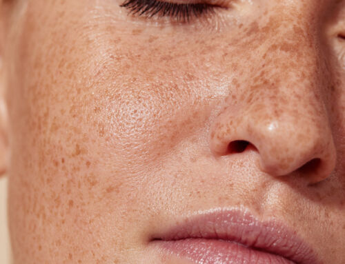 May is Skin Cancer Awareness Month: Skin cancer prevention starts early – and  matters at every age